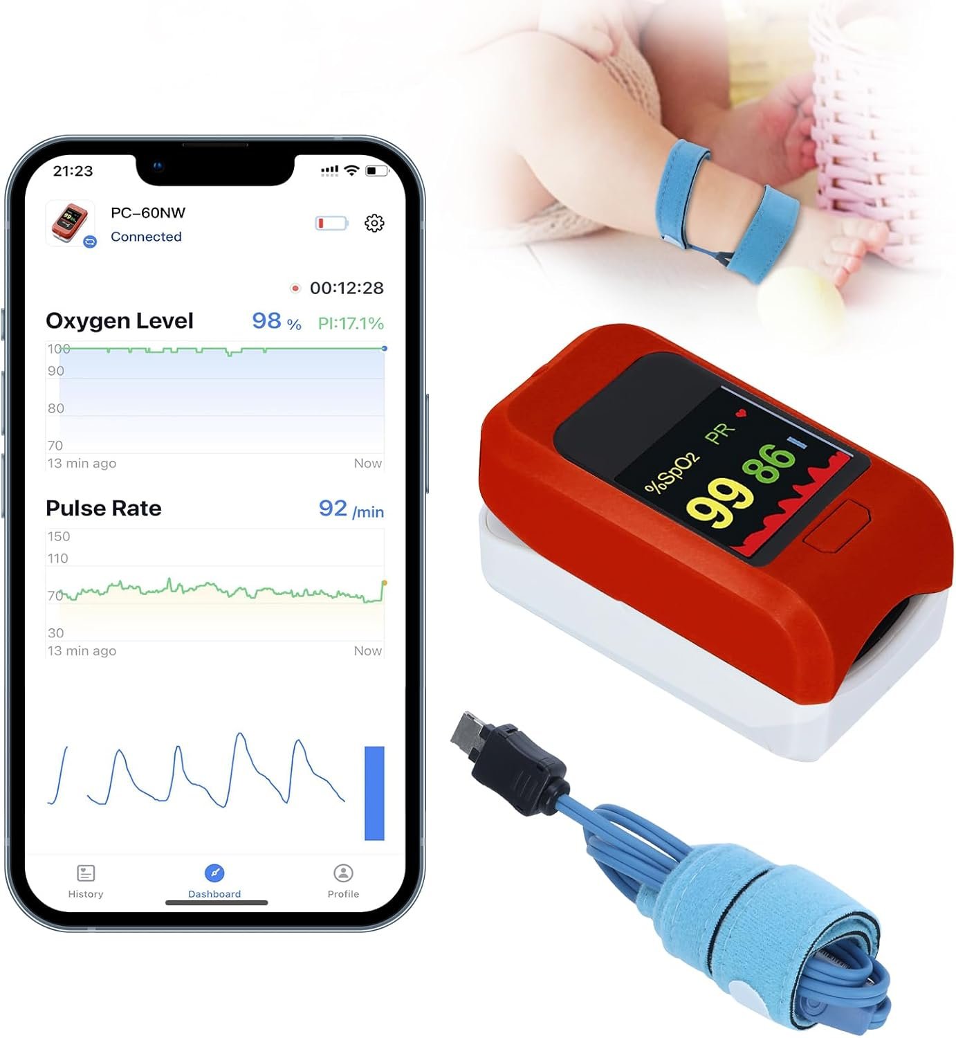 Baby Oxygen Monitor with Bluetooh App, Tracks Baby’s Heart Rate, Oxygen Level, Baby Sleep Monitor, Adjustable Foot Band for 0-36 Months Infant, Non-Medical Use Only